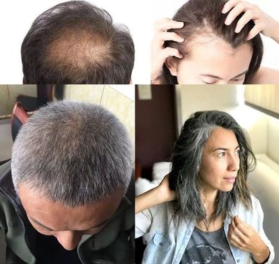 洗頭水中撒一把，頭發長得又快又茂密，白發都沒了！